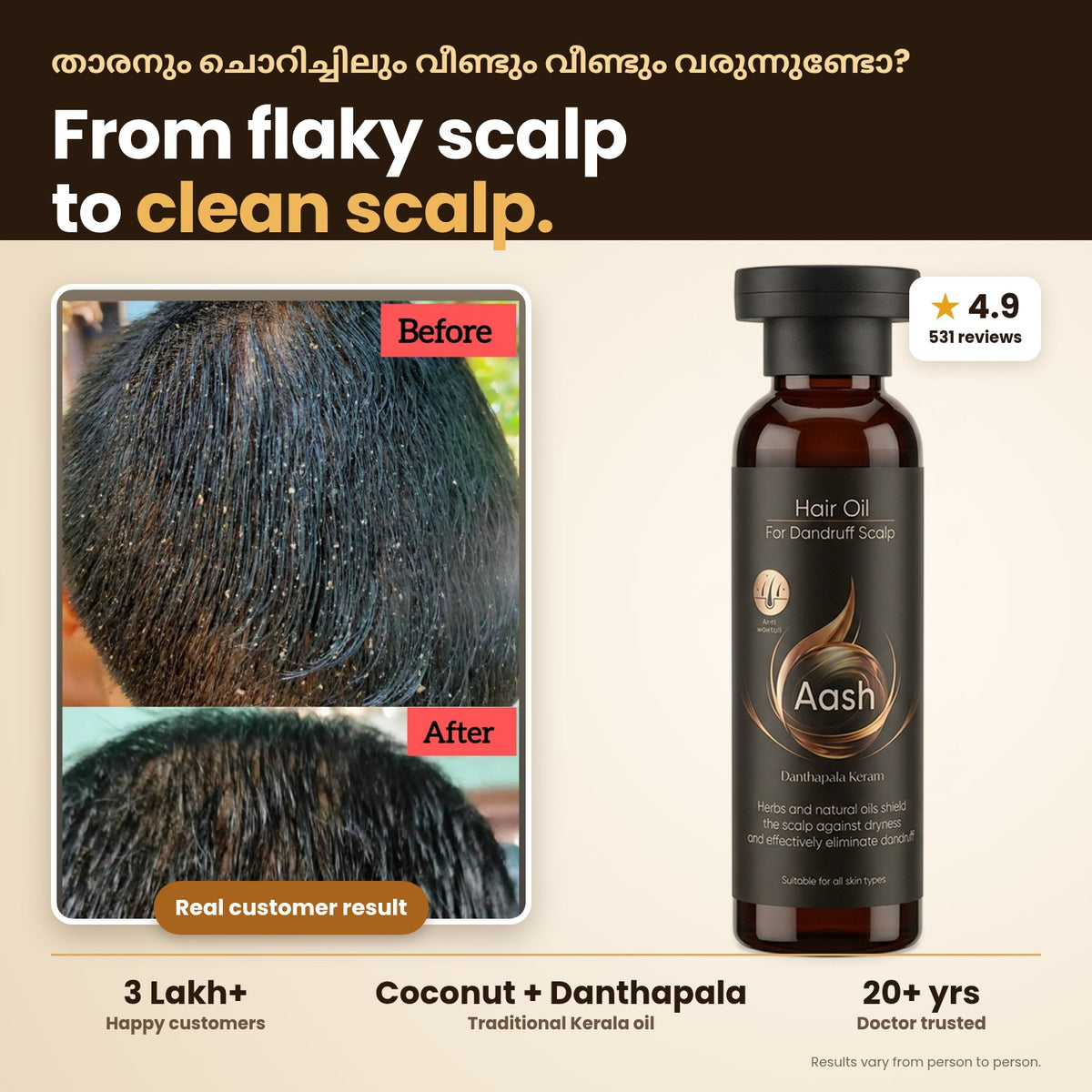 Value Pack: 3 Anti Dandruff Oils + 1 Daily Cleansing Shampoo