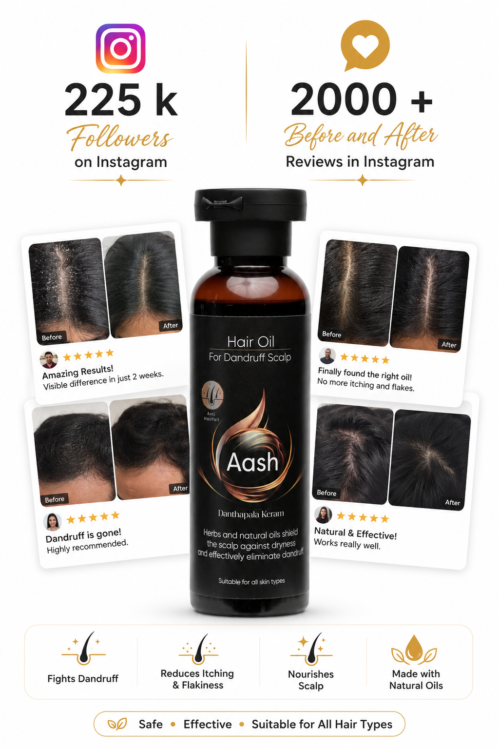 Anti Dandruff Hair Oil